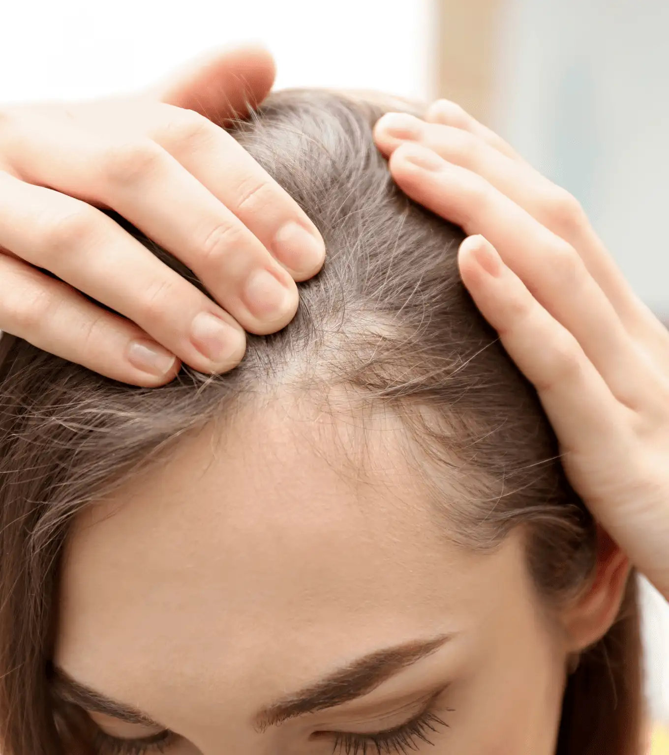 Hair Loss And Thinning